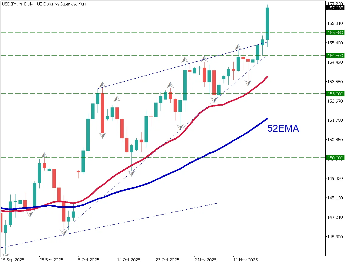 ドル円が157円を突破、日本版トラスショックは起きるのか